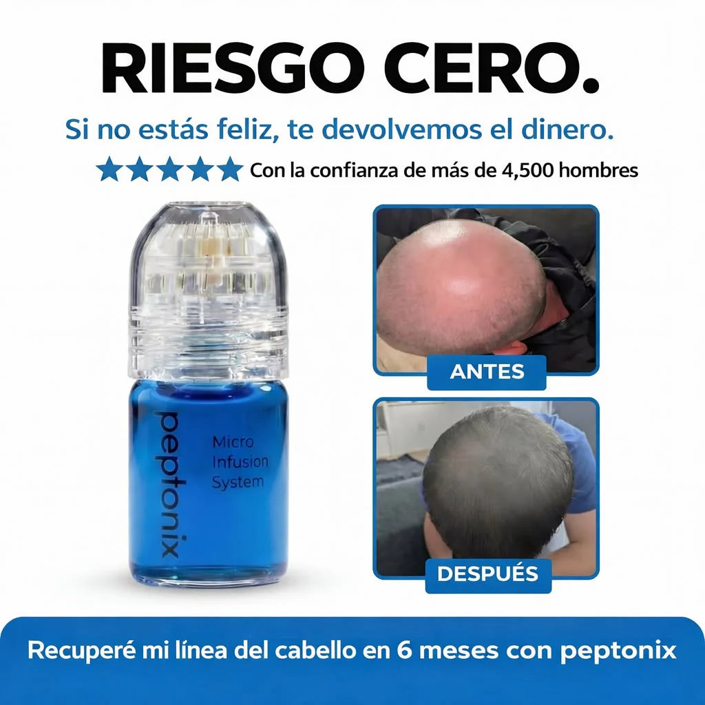 El sistema de microinfusión para el crecimiento del cabello