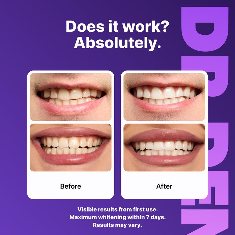 Tiras Blanqueadoras – DR.DENT ORIGINAL